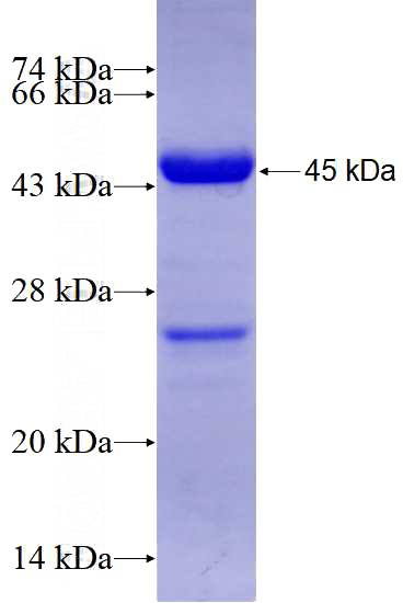 Recombinant Human MICAL1 SDS-PAGE