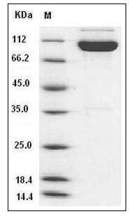 Human EphA4 Protein (His & Fc Tag) SDS-PAGE