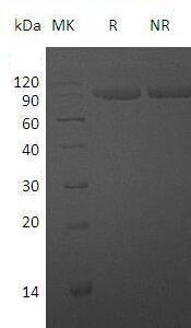 Human IL1R2/IL1RB (Fc tag) recombinant protein