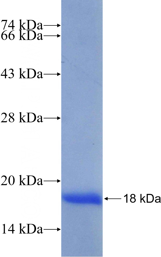 Recombinant Human CRX SDS-PAGE