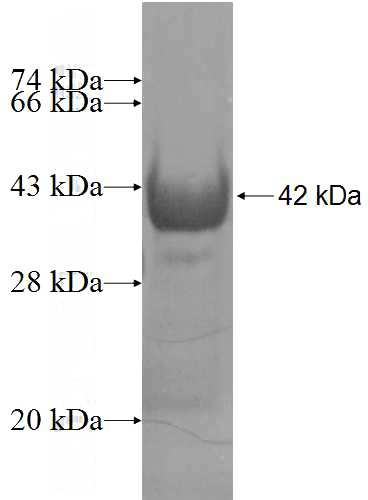 Recombinant Human QRSL1 SDS-PAGE
