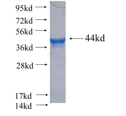 Recombinant human PML SDS-PAGE