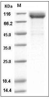 Human LIMP-2 / SCARB2 / CD36L2 Protein (His & Fc Tag) SDS-PAGE