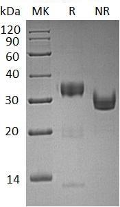 Human KLK10/NES1/PRSSL1 (His tag) recombinant protein