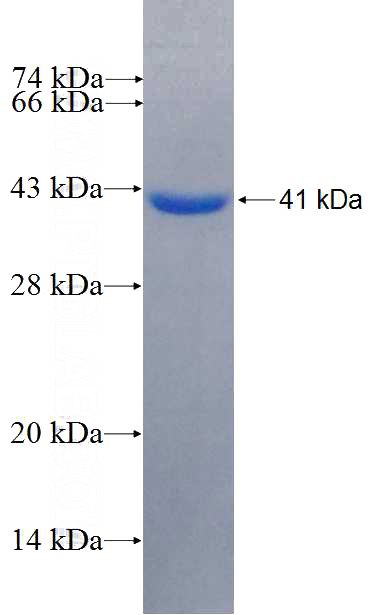 Recombinant Human CCNG2 SDS-PAGE