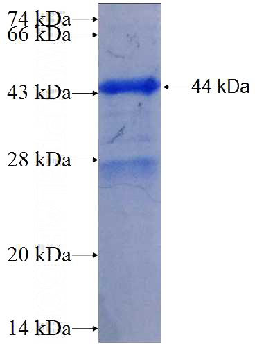 Recombinant Human LAMB3 SDS-PAGE