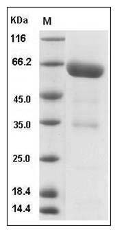 Human NRG1-alpha Protein (Fc Tag) SDS-PAGE