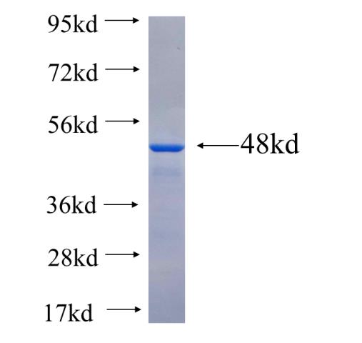Recombinant human PDGFRL(Full length) SDS-PAGE