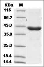 Human ACAA1 / PTHIO Protein (His Tag)