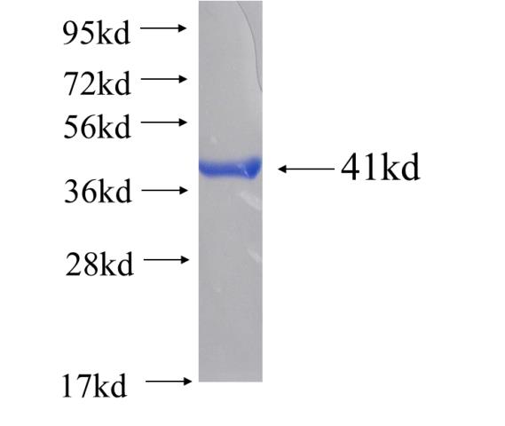Recombinant human ATL2 SDS-PAGE