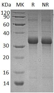 Human FSTL1/FRP recombinant protein