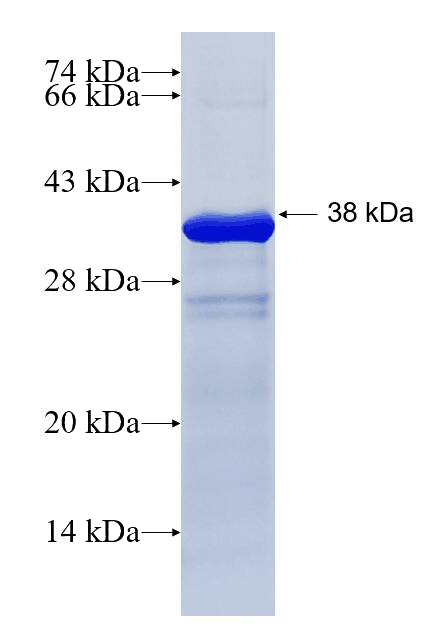 Recombinant human NELL1 SDS-PAGE