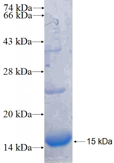 Human EFNB2 Recombinant protein (6*His tag)