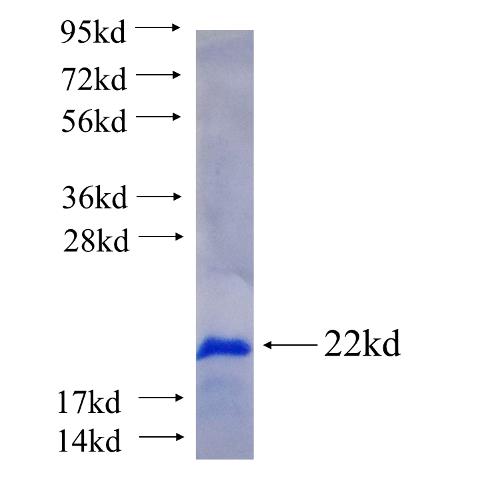 Recombinant human THAP2 SDS-PAGE