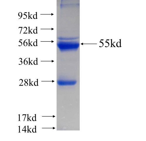 Recombinant human RPS4Y1 SDS-PAGE