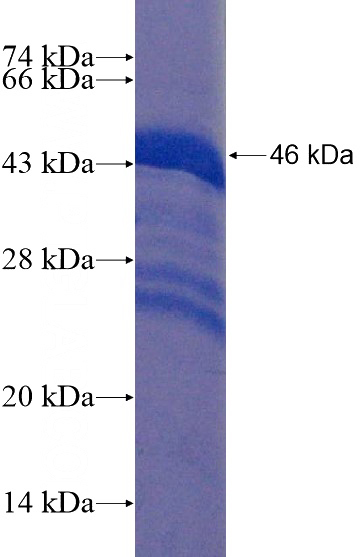 Recombinant Human RAX SDS-PAGE