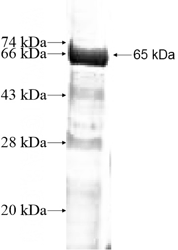 Recombinant Human KLHDC4 SDS-PAGE