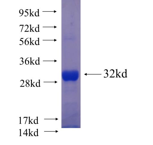 Recombinant human HECTD3 SDS-PAGE