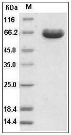 Human ESAM / Endothelial Cell Adhesion Molecule Protein (Fc Tag) SDS-PAGE
