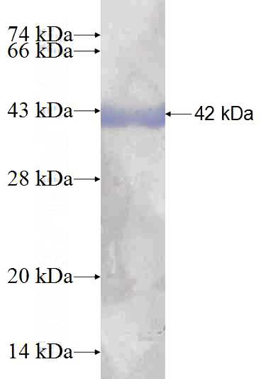Recombinant Human GIPC1 SDS-PAGE