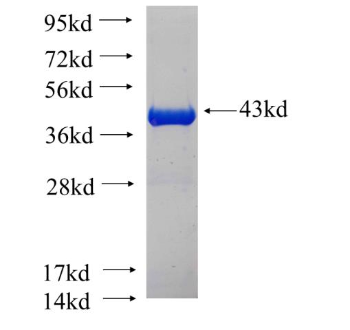 Recombinant human DALRD3 SDS-PAGE