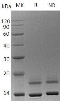 Human CST6 (His tag) recombinant protein