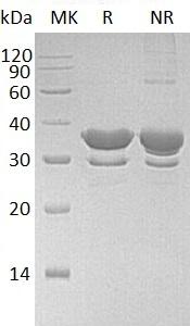 Human SULT2A1/HST/STD (His tag) recombinant protein