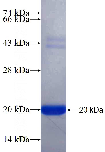 Recombinant Human LMBRD1 SDS-PAGE