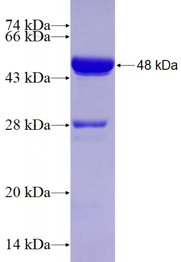 Recombinant Human RRBP1 SDS-PAGE