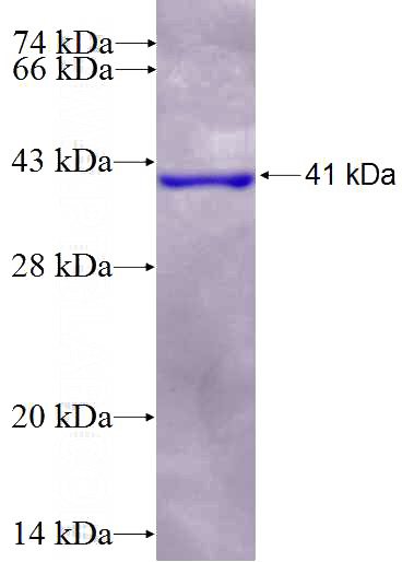 Recombinant Human MOV10 SDS-PAGE