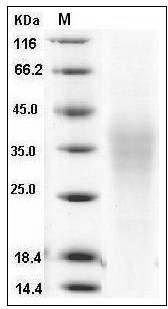 Human TRAIL R4 / CD264 / TNFRSF10D Protein (His Tag) SDS-PAGE