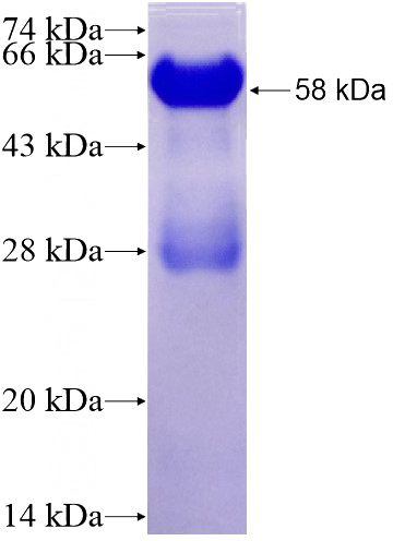 Recombinant Human GAB1 SDS-PAGE