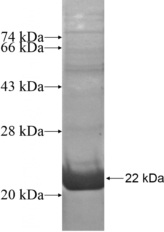 Recombinant Human CHRNG SDS-PAGE