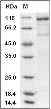 Human VEGFR2 / Flk-1 / CD309 / KDR Protein (His & GST Tag) SDS-PAGE