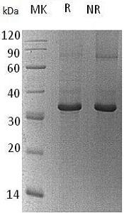 Human PPIC/CYPC (Trx & His tag) recombinant protein