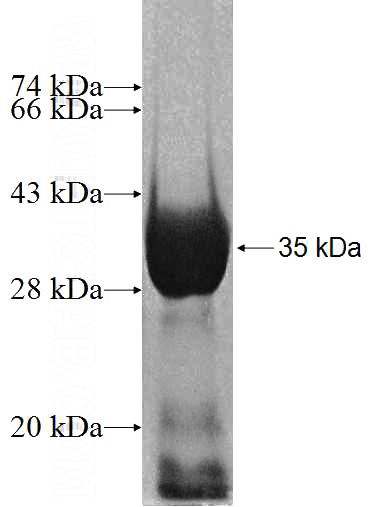 Recombinant Human GRIPAP1 SDS-PAGE