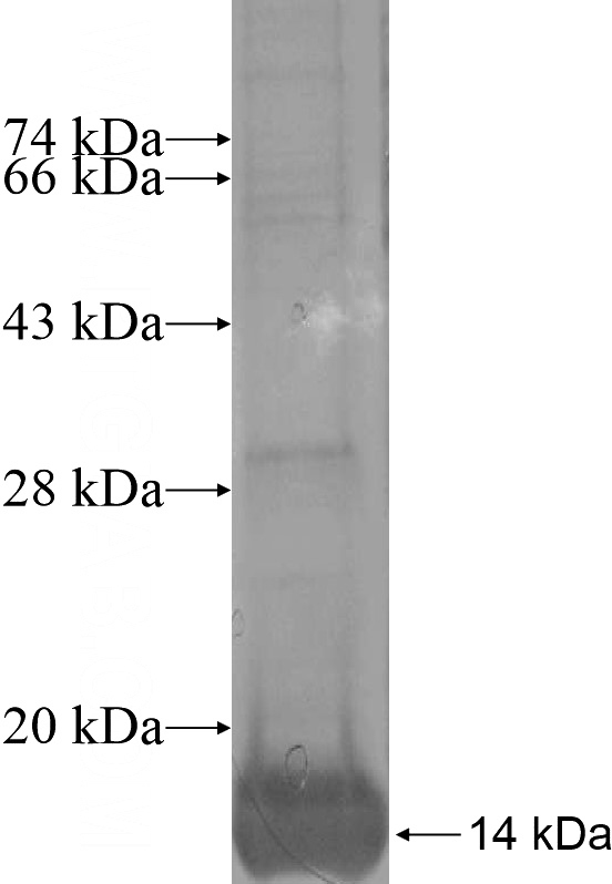 Recombinant Human NKAIN4 SDS-PAGE