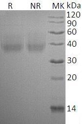 Rat Cd80/B7.1 (His tag) recombinant protein