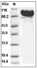 Human MMP-9 / CLG4B Protein (His Tag) SDS-PAGE