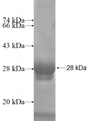 Recombinant Human MED28 SDS-PAGE