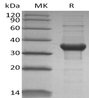 2019-nCoV Papain-Like Protease