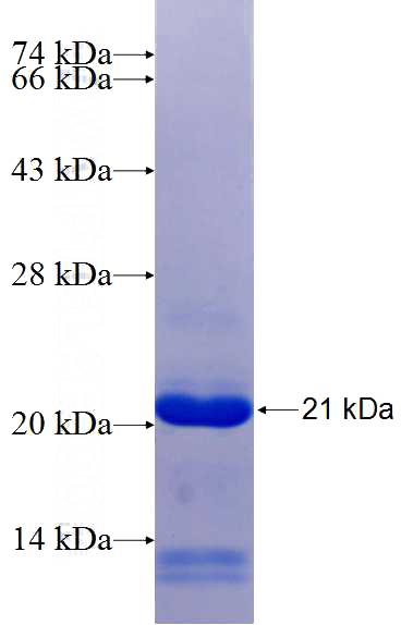 Recombinant Human SSH1 SDS-PAGE