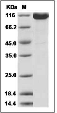 Cynomolgus ENPP3 / CD203c Protein (His Tag) SDS-PAGE