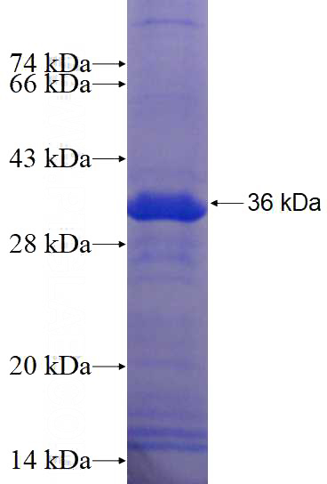Recombinant Human SERPINB7 SDS-PAGE