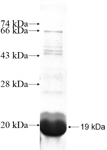 Recombinant Human SLC38A4 SDS-PAGE