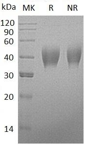 Human HEPACAM (His tag) recombinant protein