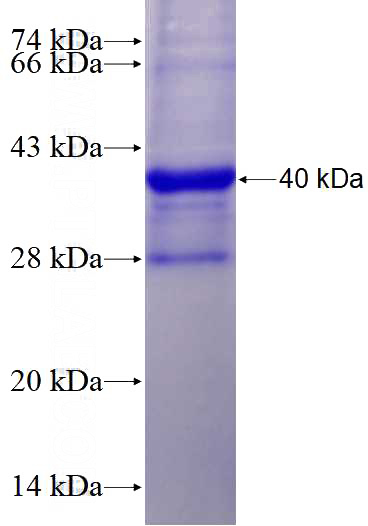 Recombinant Human GYS2 SDS-PAGE