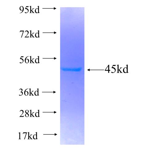 Recombinant human MYO1F SDS-PAGE