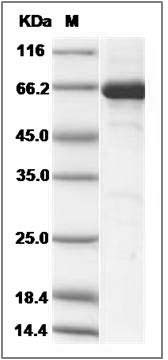 Human EphB3 / HEK2 Protein (aa 585-998, His & GST Tag) SDS-PAGE