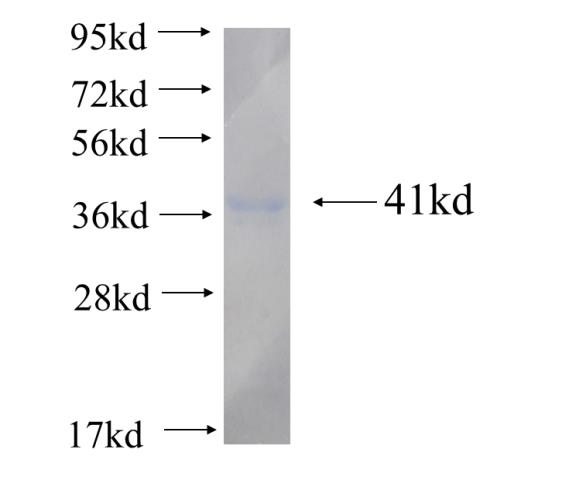 Recombinant human PRPS1(Full length) SDS-PAGE